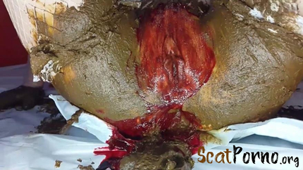 Anna Coprofield - Shit and Blood Vol.6 Filled Pussy Part 2