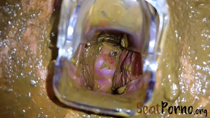 Anna Coprofield - Tampon, Speculum Filled Pussy Part 2
