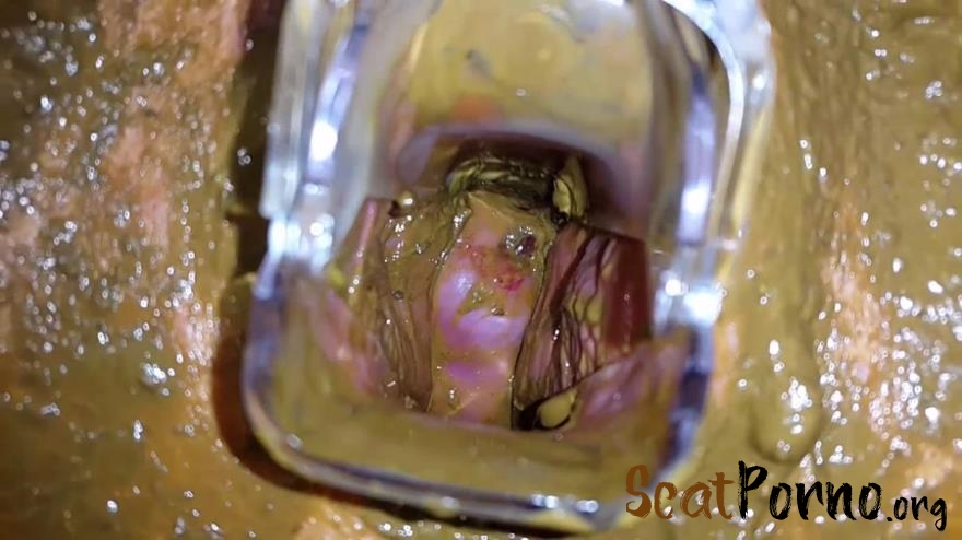 Anna Coprofield - Tampon, Speculum Filled Pussy Part 2