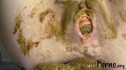 Pooping big shit and stuffing it inside with p00girl Prolapse