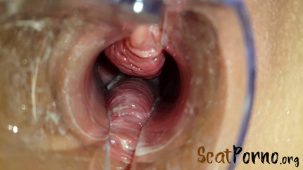 Through the Speculum Filled Pussy Part 1 with Anna Coprofield