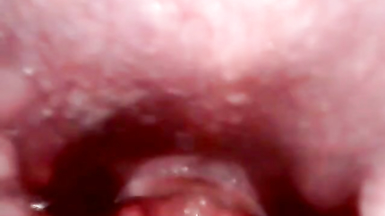 GIRL ENDOSCOPE GAGGING