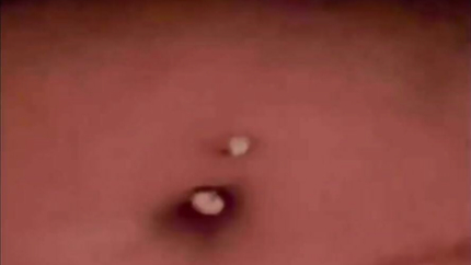 CHUBBY MORNING SICKNESS