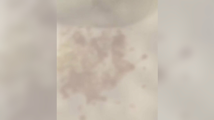 MORNING SICKNESS IN COLLAGE