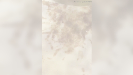 MORNING SICKNESS IN COLLAGE