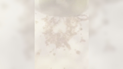 MORNING SICKNESS IN COLLAGE