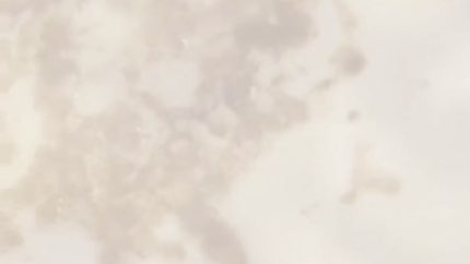 MORNING SICKNESS IN COLLAGE