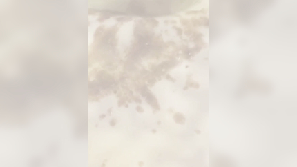 MORNING SICKNESS IN COLLAGE