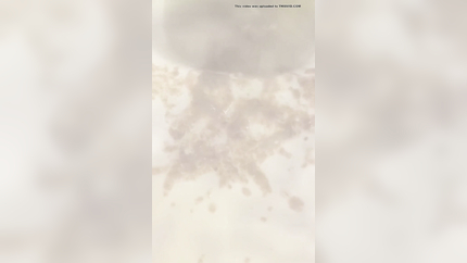 MORNING SICKNESS IN COLLAGE