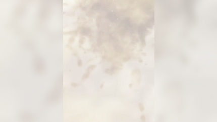 MORNING SICKNESS IN COLLAGE