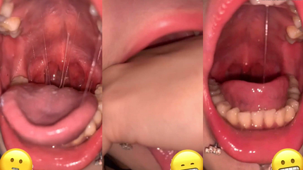 CHINESE GIRL PUKES IN MOUTH