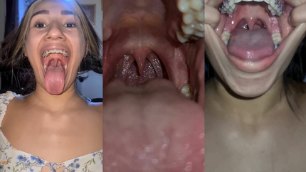 KU PUKE, BURP AND COUGH