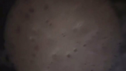 GIRLS SO SICK AND VOMITS AGAIN