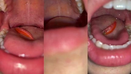 CUTE CHINESE GIRL SWALLOW FISH AND PUKE OUT PART 1