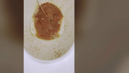 LATE NIGHT PUKE