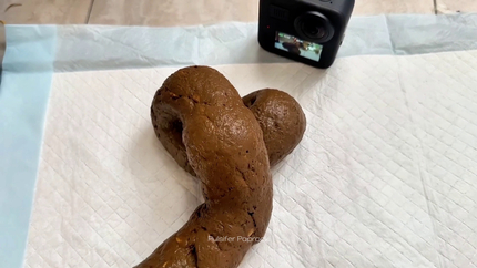 Scared Shitless 5 Day Post-op Poop. P1