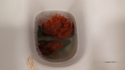 Constipated Dose In Your Mouth