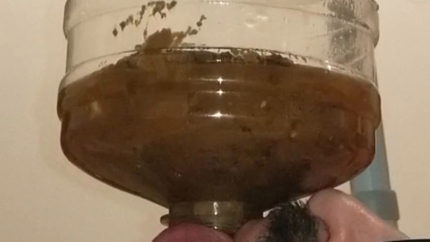 Chugging LITERS of my poop-flavored pee