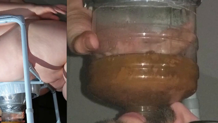 Chugging LITERS of my poop-flavored pee