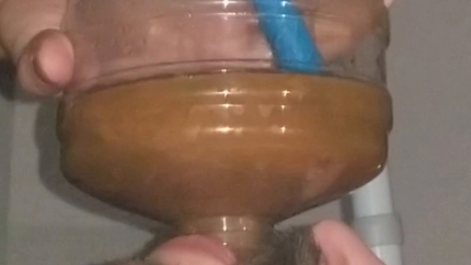 Chugging LITERS of my poop-flavored pee