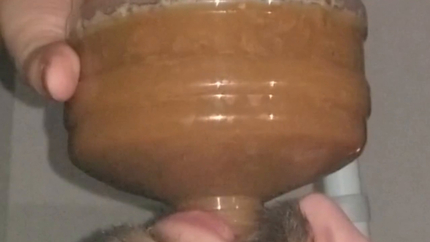 Chugging LITERS of my poop-flavored pee