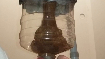Chugging LITERS of my poop-flavored pee