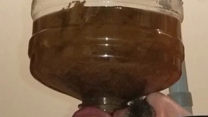 Chugging LITERS of my poop-flavored pee