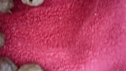 Peeing on towel, pooing on toilet and pooping on towel