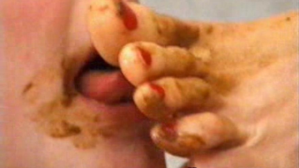 Fanny Steel - Sycologist And Patient