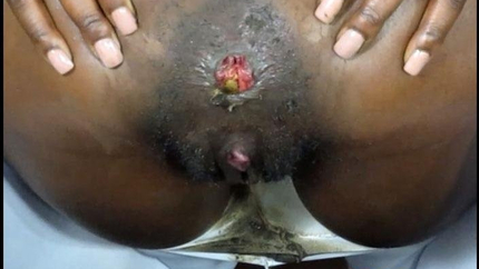 Scat Giorgia - Butthole Play In Sexy White Stockings