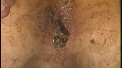 B-Engel Dirty 2 - Skinhead Honsa – Natursekt und Kaviar Part 2
