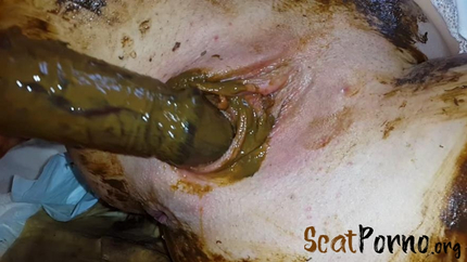 Anna Coprofield - Gynecological Self-Examination Shit - Filled Pussy Thought The Speculum